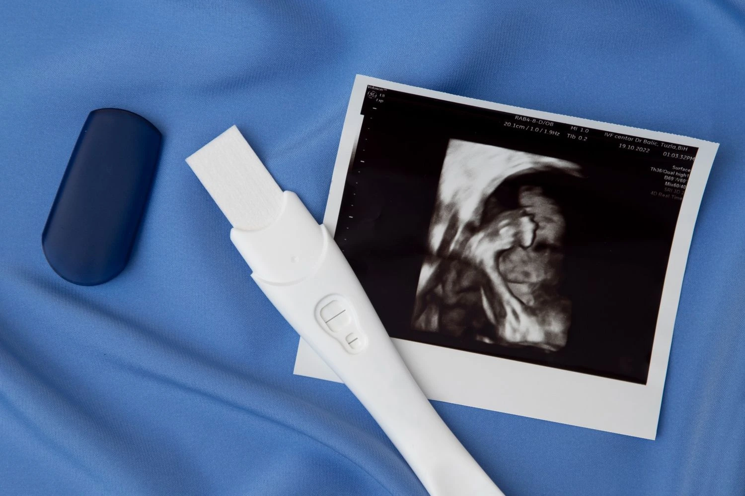 Early Pregnancy Scans (6–9 Weeks): Dating, Viability & Heartbeat
