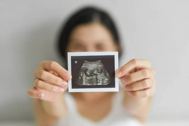 Anomaly scan and TIFFA at Meera 4D Scans Madurai affordable antenatal scan cost