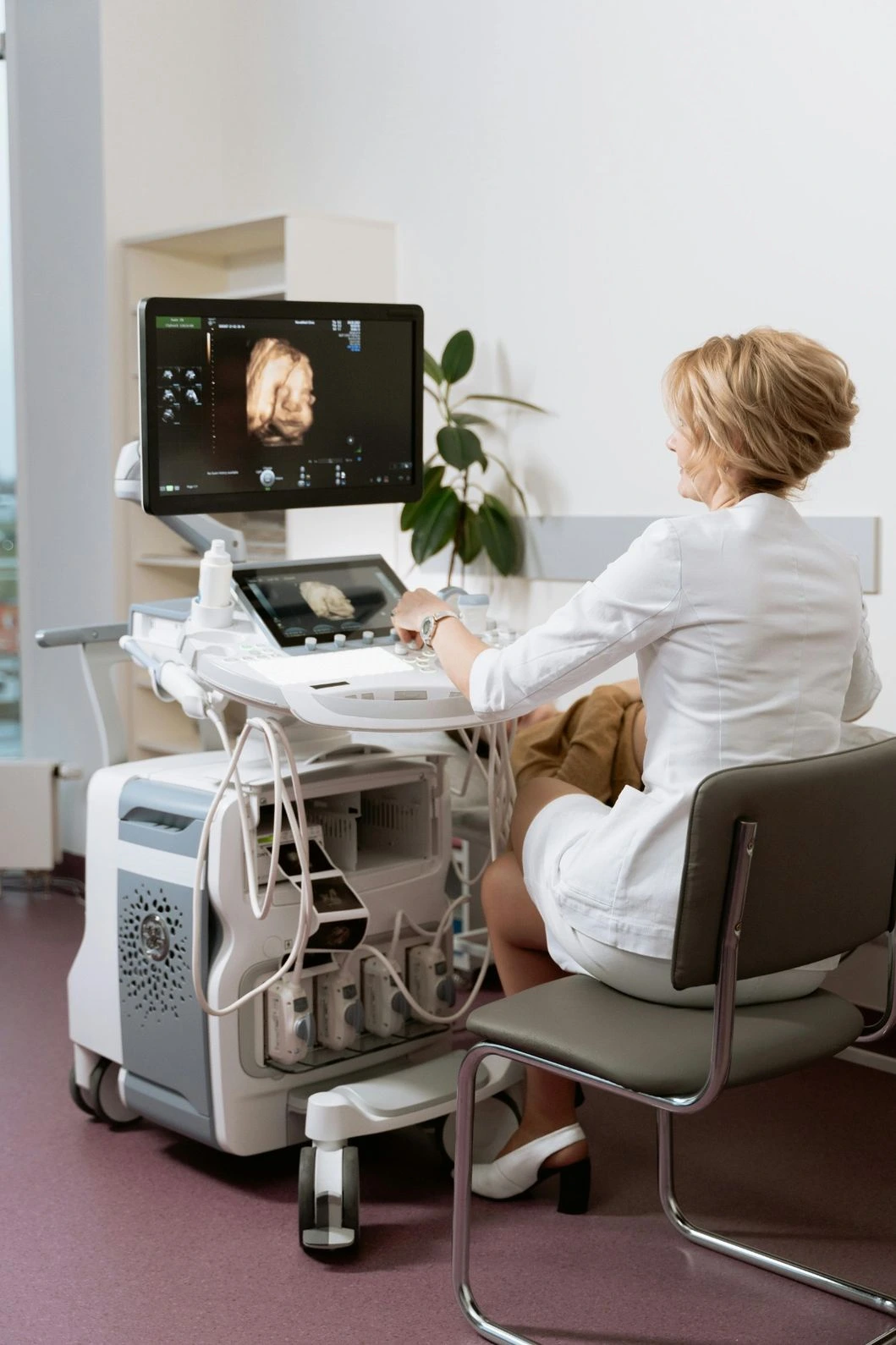 Umbilical artery Doppler ultrasound blood flow monitoring in pregnancy at Meera 4D Scans Madurai