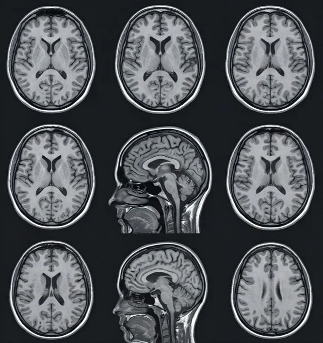 Patient receiving MRI scan at affordable scanning centre near me in Madurai