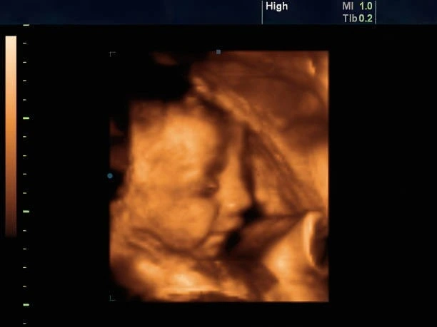 Anomaly Scan