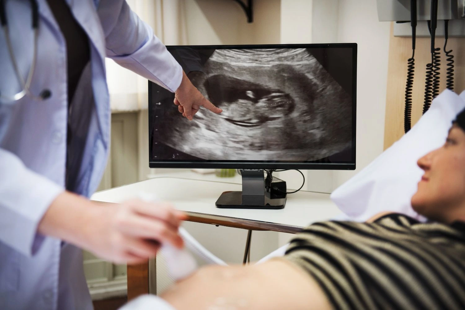 Pregnancy Scan
